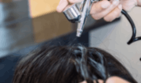 Anti Dandruff Treatment