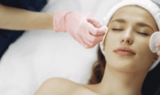 Chemical Peel